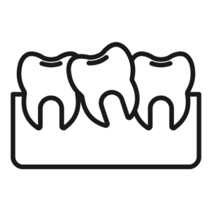 Misaligned teeth