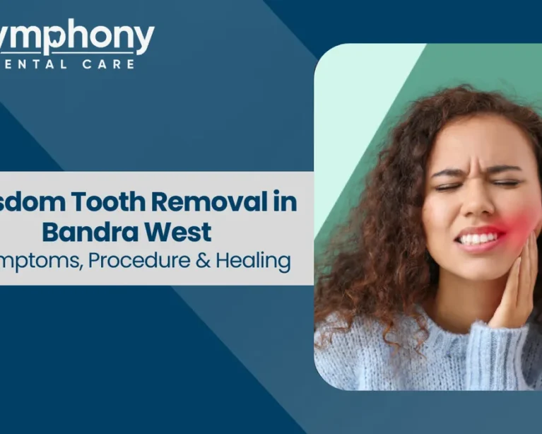 Wisdom tooth removal in bandra west