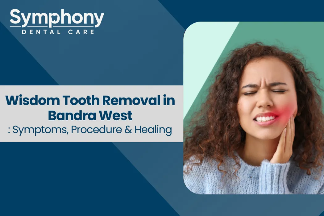Wisdom tooth removal in bandra west