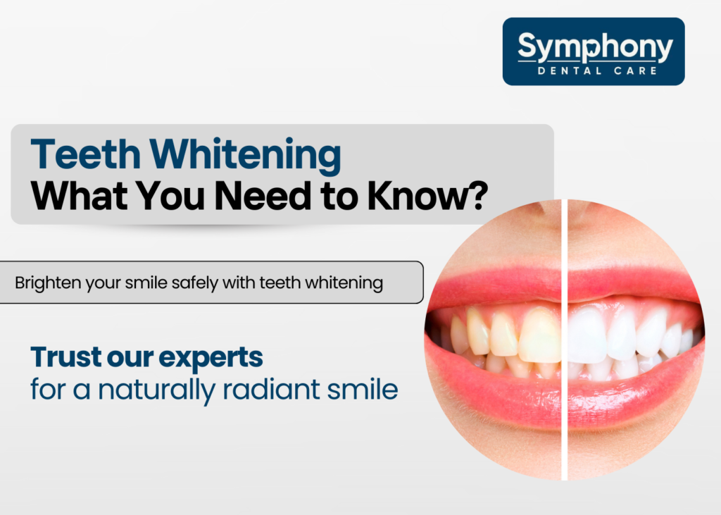 Teeth Whitening