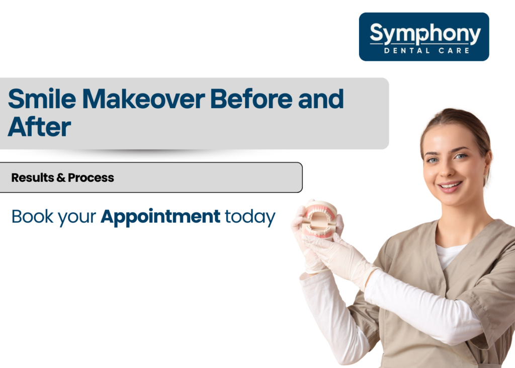 Smile makeover in Khar West