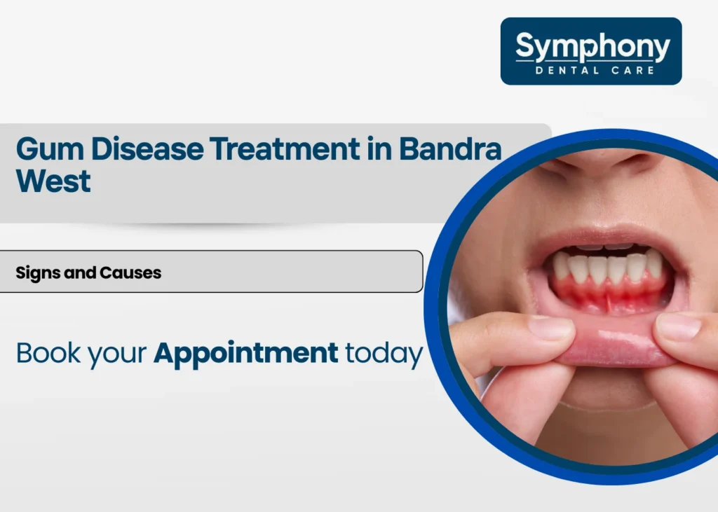 gum disease treatment in Bandra West