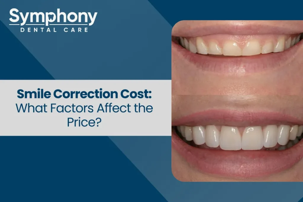 Smile Correction cost in Bandra