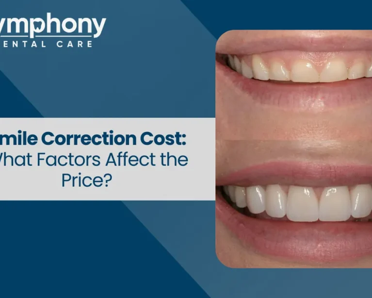 Smile Correction cost in Bandra