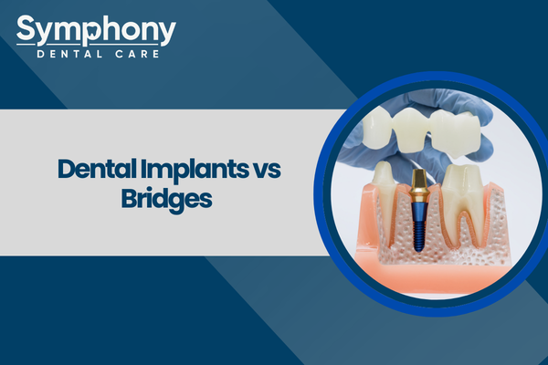 dental implants vs bridges