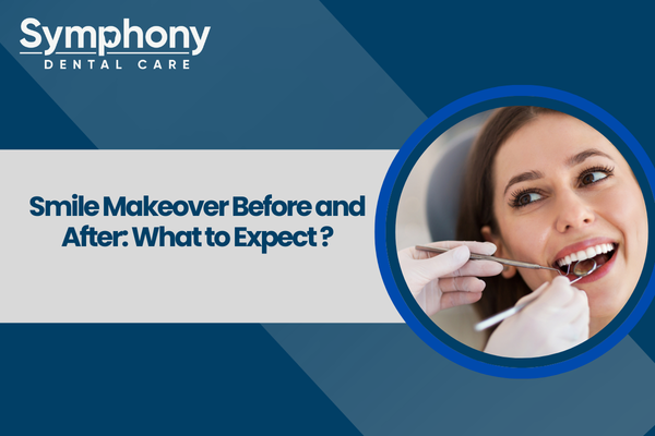 smile makeover in Bandra West