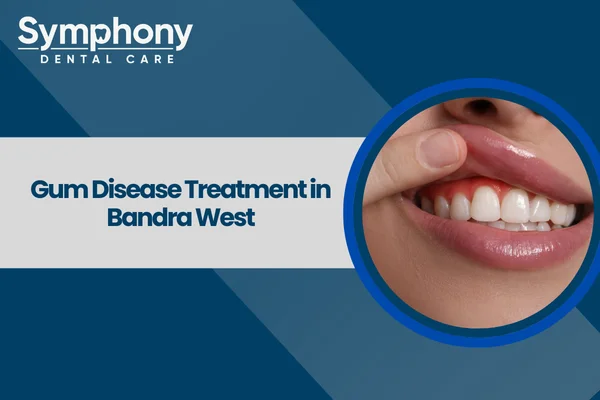 gum disease treatment in Bandra West