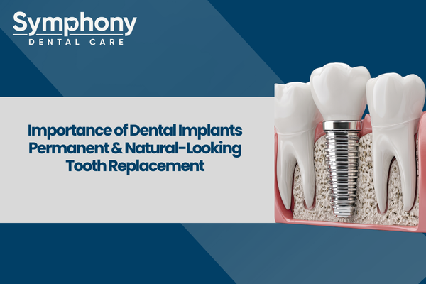 dental implants