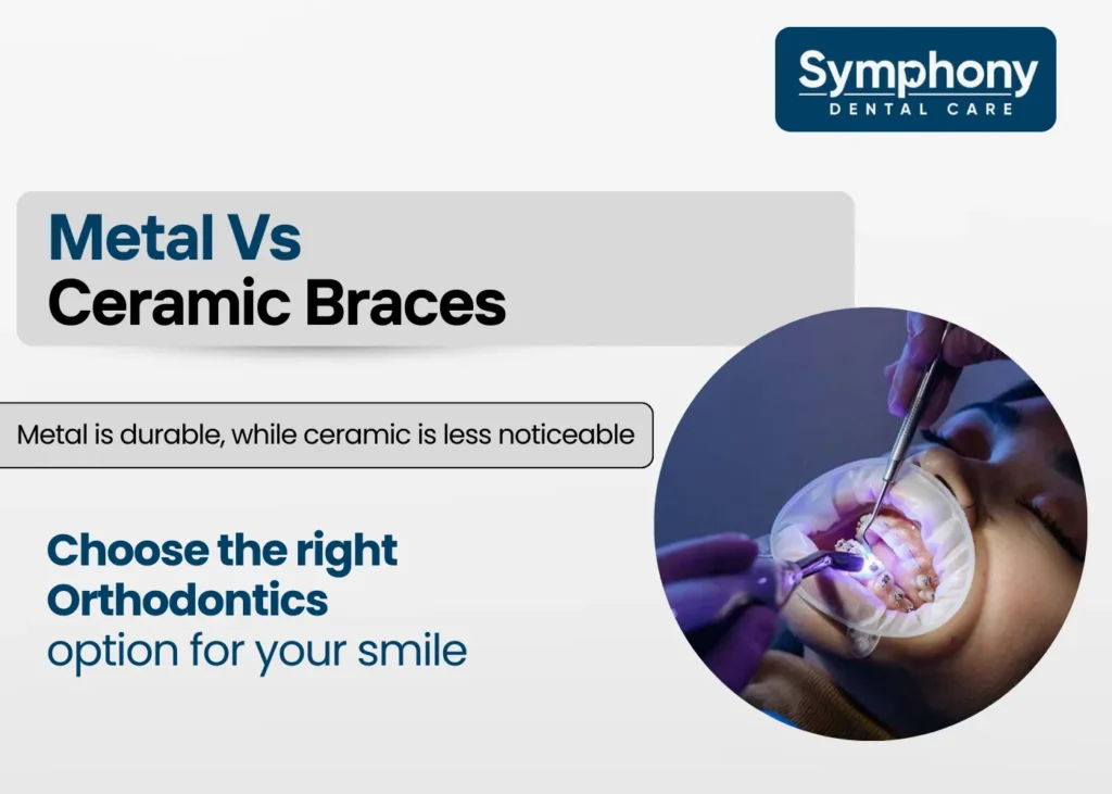 difference between metal and ceramic braces