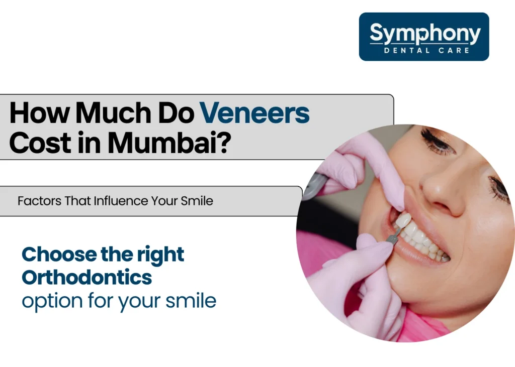 veneers cost in mumbai