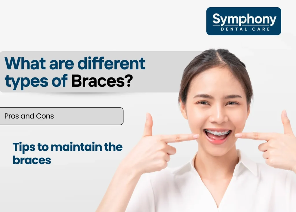 different types of braces