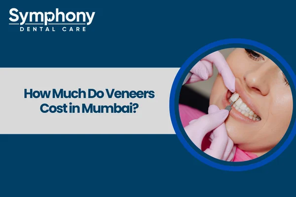 veneers cost in mumbai