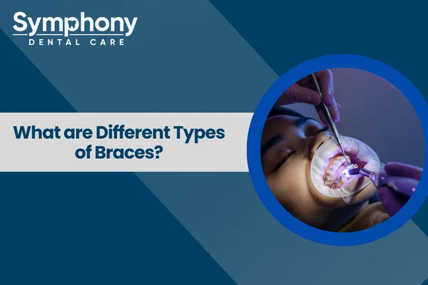different types of braces