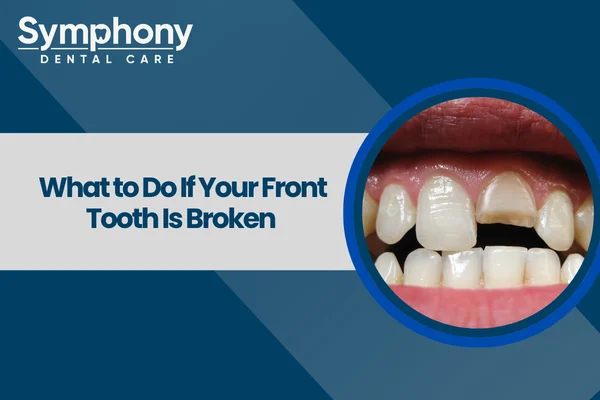 what to do if your front tooth is broken?