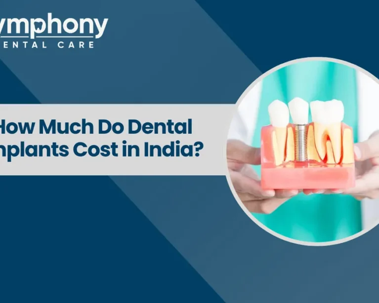 Dental Implants Cost in India