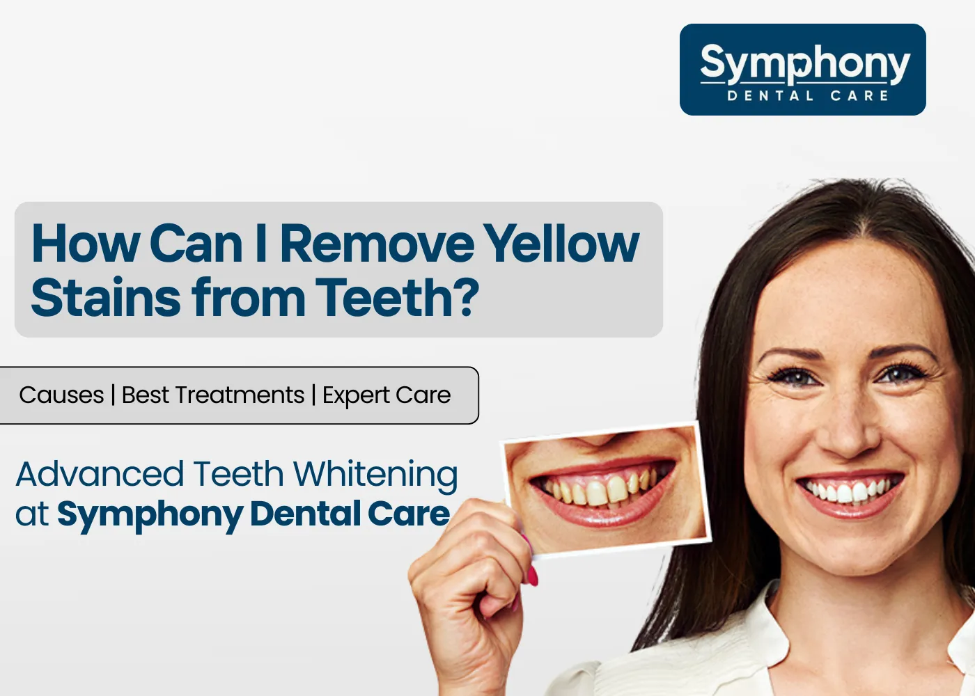 How Can I Remove Yellow Stains from Teeth