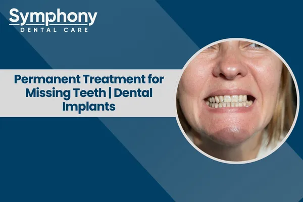 Best Treatment for Missing Teeth