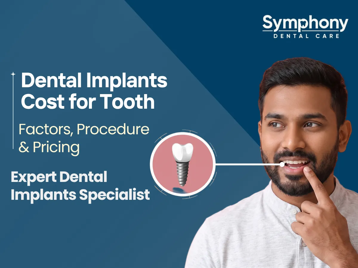 Dental Implants Cost Per Tooth