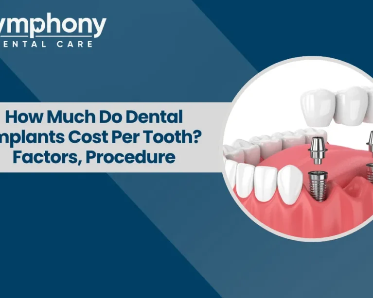 How Much Do Dental Implants Cost Per Tooth