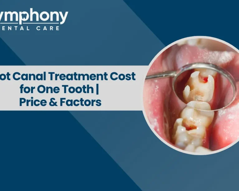 Root Canal Treatment Cost Mumbai