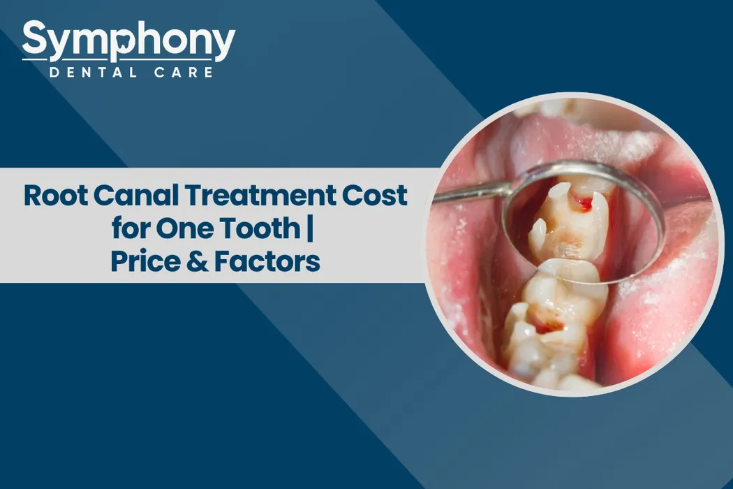 Root Canal Treatment Cost Mumbai