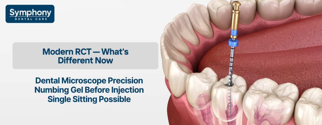Root Canal Treatment in Bandra West Mumbai using dental microscope painless technology