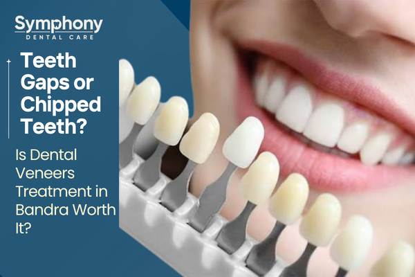 dental veneers treatment in Bandra West Mumbai fixing chipped and gapped teeth