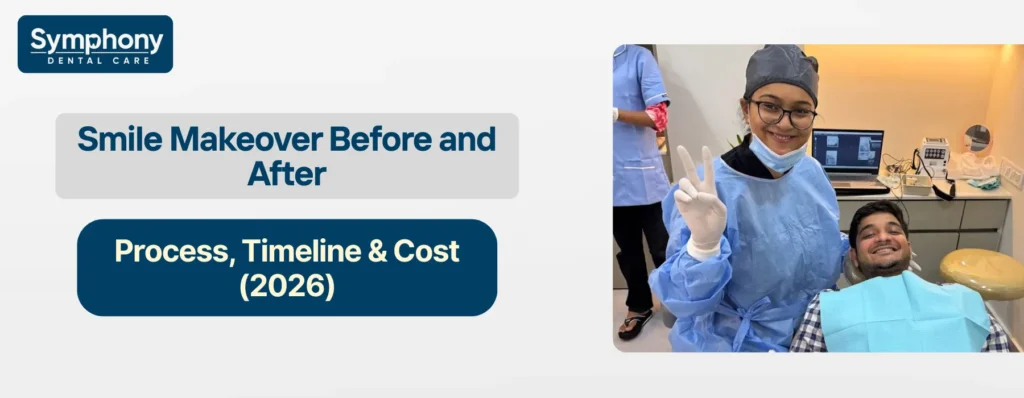 Smile Makeover Before and After