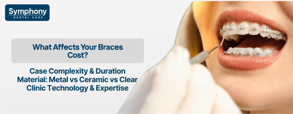 teeth braces cost in Bandra factors affecting treatment price Symphony Dental Care