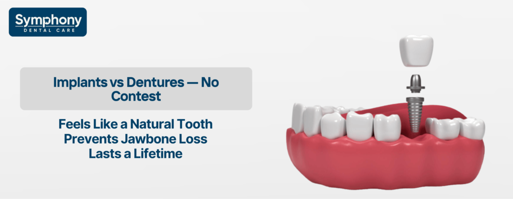 dental implants in Bandra Mumbai gold standard vs dentures comparison
