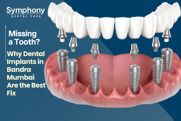 dental implants in Bandra Mumbai permanent missing tooth fix Symphony Dental Care