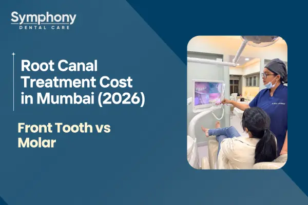 cost of root canal treatment Mumbai
