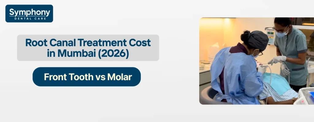 root canal treatment cost in mumbai