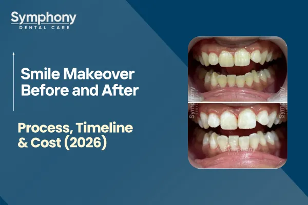 smile makeover procedure