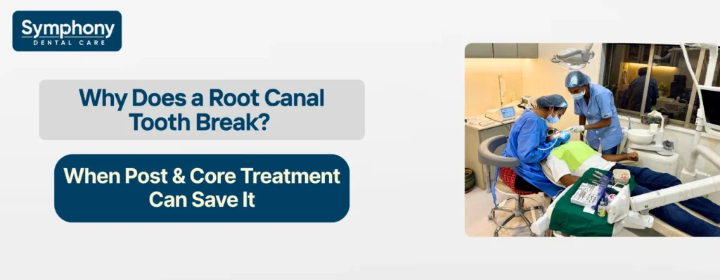 Why Does a Root Canal Tooth Break
