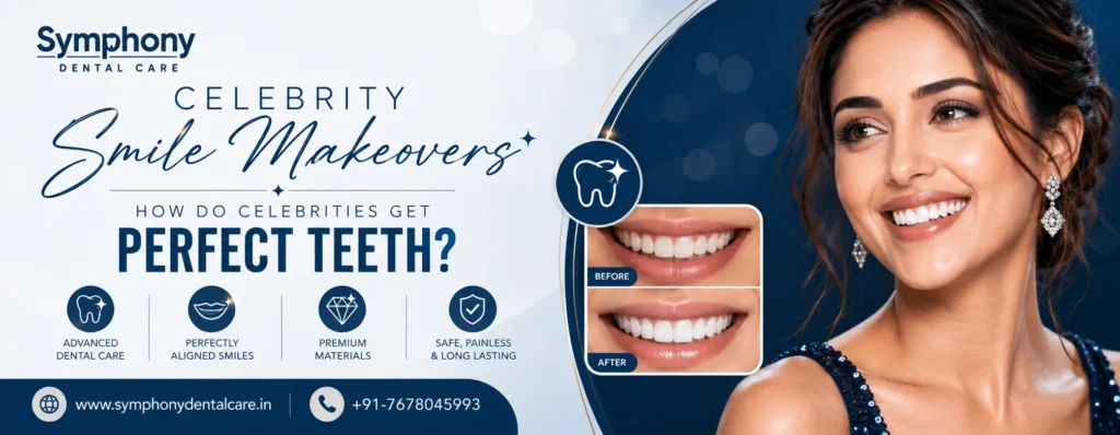 Celebrity Smile Makeovers Bandra