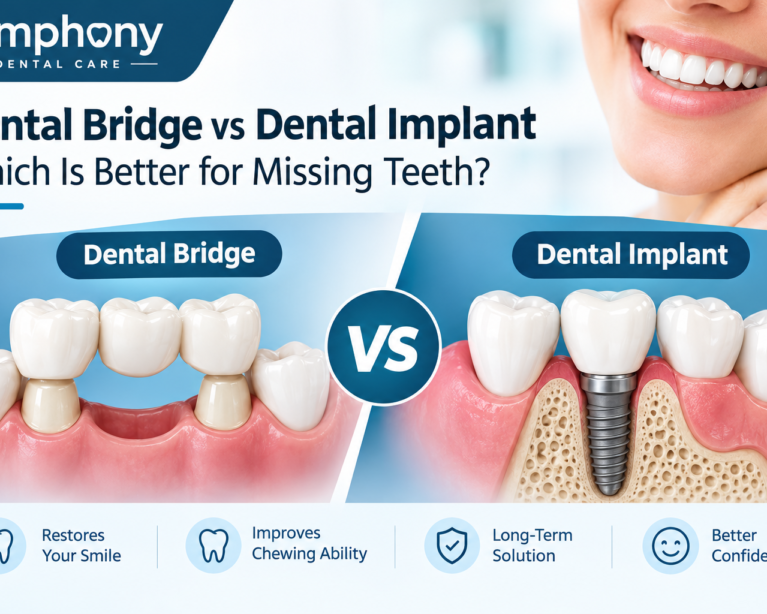 Dental Bridge vs Dental Implant