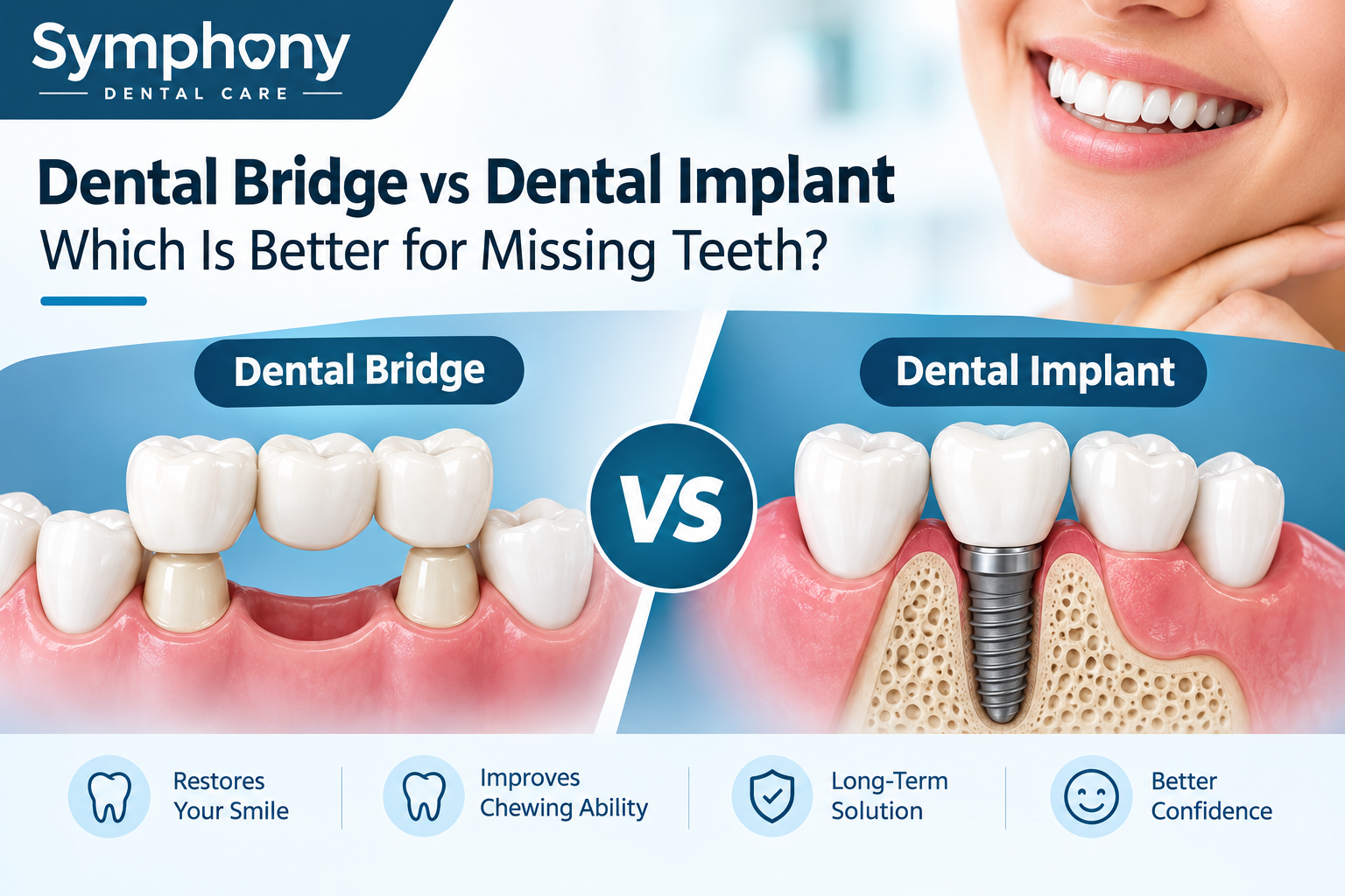 Dental Bridge vs Dental Implant