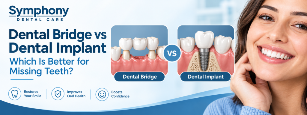 Dental Bridge vs Dental Implant