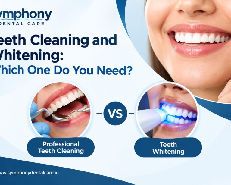 Teeth Cleaning and Whitening: Which One Do You Need?