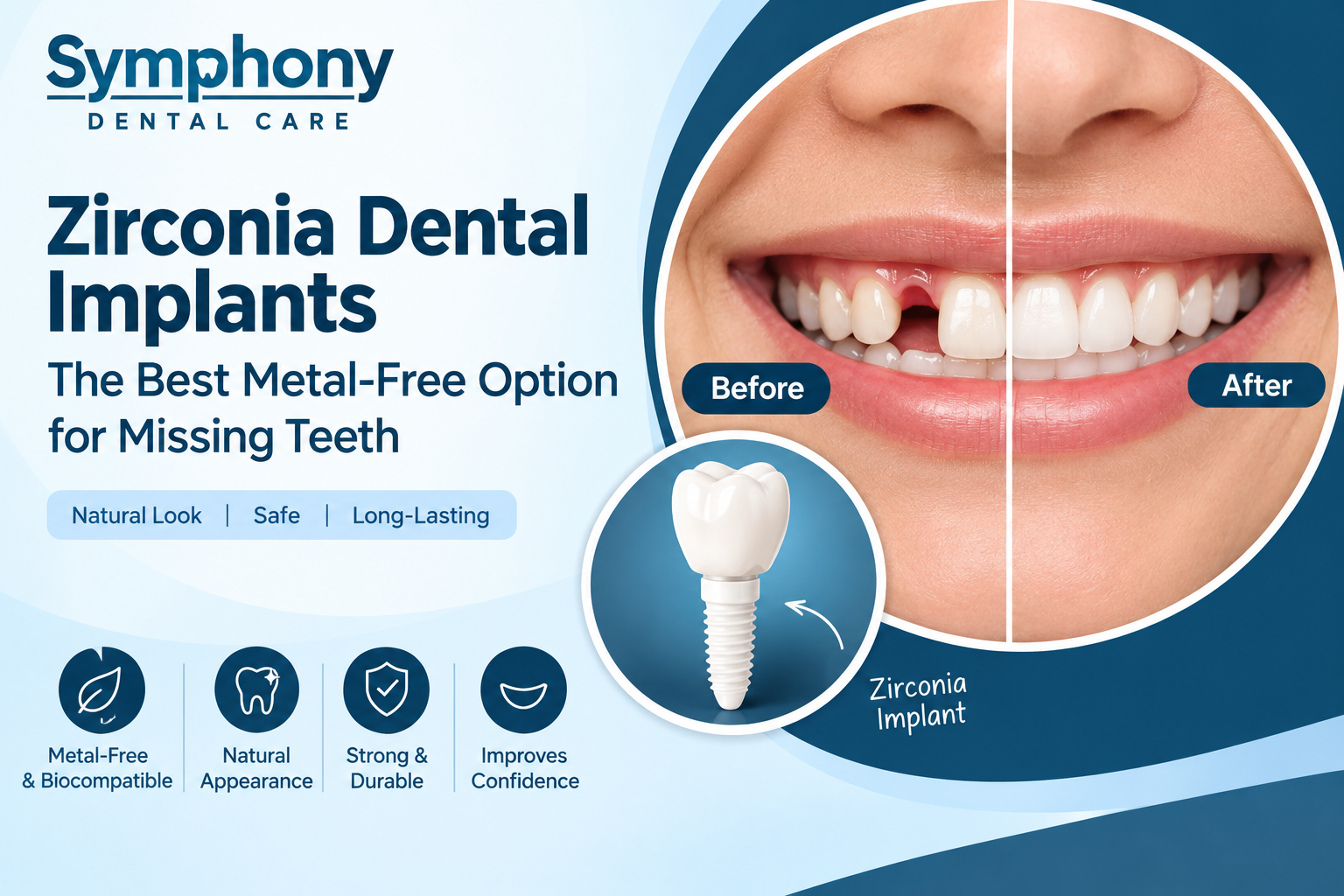 Zirconia Dental Implants